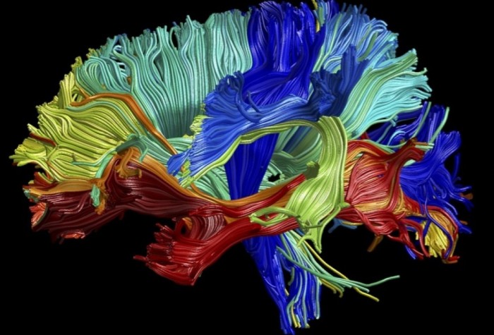 4_brains_fibertracts